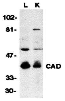 Western blot analysis of mouse lung (L) and kidney (K) tissue lysates using CAD antibody 
