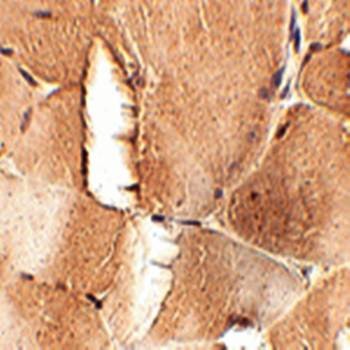  Immunohistochemical analysis of formalin-fixed and paraffin-embedded mouse skeletal muscle tissue at 2.5 ug/mL using JPH1 antibody