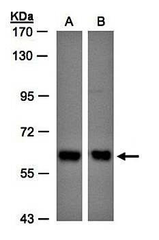 Western Blot analysis of A:H1299 whole cell lysate using COPD antibody 