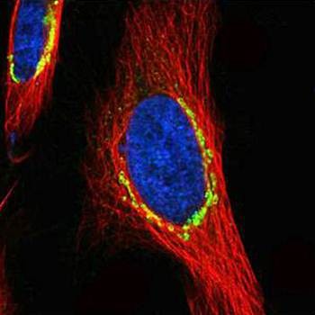  Confocal immunofluorescence analysis of paraformaldehyde-fixed HeLa using COPD antibody