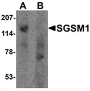 Western blot analysis of human cerebellum tissue lysate at 1 ug/ml in (A) the absence and (B) the presence of blocking peptide using SGSM1 antibody