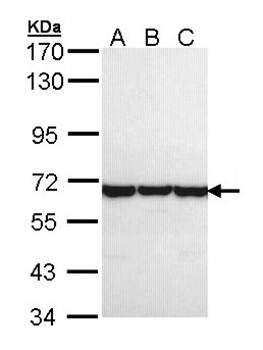 Western Blot analysis of A:A431, B:H1299, C:Hela whole cell lysate using TCP 1 theta antibody 