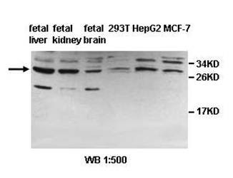  Western blot analysis of fetal liver,fetal kidney,fetal brain,293T,HepG2,MCF-7 lysate using PDCL2 antibody