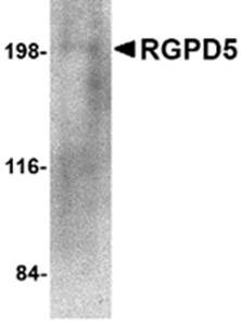 Western blot analysis of human thymus tissue lysate at 1 ug/mL using RGPD5 antibody 