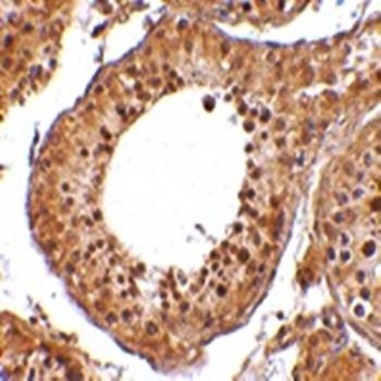  Immunohistochemical analysis of formalin-fixed and paraffin-embedded human testis tissue cells at 10 ug/mL using RGPD5 antibody