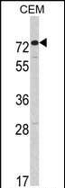 Western blot analysis of CEM cell lysates using AMHR2 antibody. 