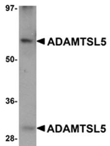 Western blot analysis of human skeletal muscle tissue lysate at 1 ug/mL using ADAMTSL5 antibody 