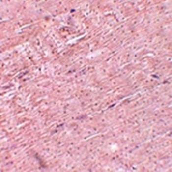  Immunohistochemical analysis of formalin-fixed and paraffin-embedded mouse skeletal muscle tissue at 5 ug/mL using ADAMTSL5 antibody