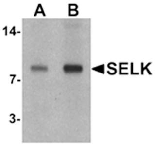 Western blot analysis of A20 cell lysate at (A) 1 and (B) 2 ug/mL using SELK antibody