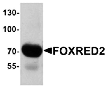 Western blot analysis of human lung tissue lysate at 1 ug/mL using FOXRED2 antibody