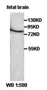 Western blot analysis of fetal brain lysate using SGSM3 antibody 