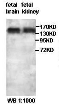 Western blot analysis of fetal brain and kidney lysate using SGSM1 antibody 
