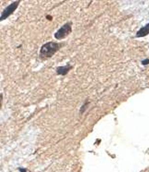  Immunohistochemical analysis of formalin-fixed paraffin embedded fetal brain showing cytoplamic staining using SGSM1 antibody