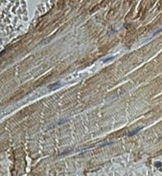  Immunohistochemical analysis of formalin-fixed paraffin embedded fetal skeletal muscle showing cytoplasmic staining using INPP5K antibody