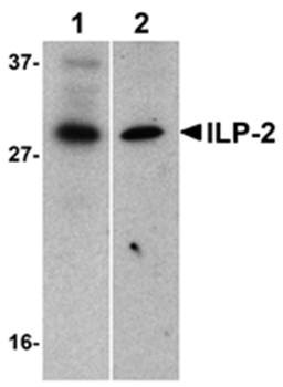Western blot analysis of human HepG2 (lane 1) and MOLT4 (lane 2) cell lysates using ILP 2 antibody 