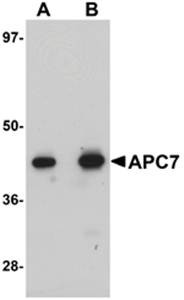Western blot analysis of rat kidney tissue lysate at (A) 1 and (B) 2 ug/mL using APC7 antibody 