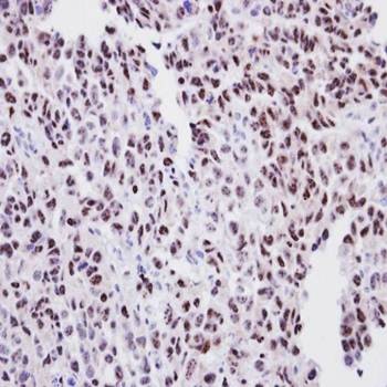  Immunohistochemical analysis of formalin-fixed and paraffin-embedded CL1-0 Xenograft using ORC2 antibody