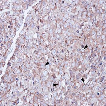  Immunohistochemical analysis of formalin-fixed and paraffin-embedded CL1-0 xenograft using SCARA3 antibody