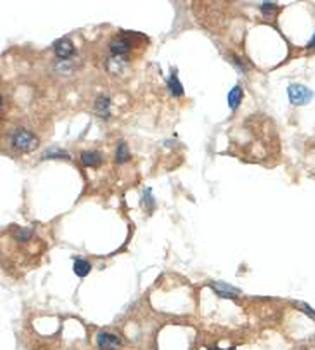  Western blot analysis of fetal lung lysate lysate using HK2 antibody