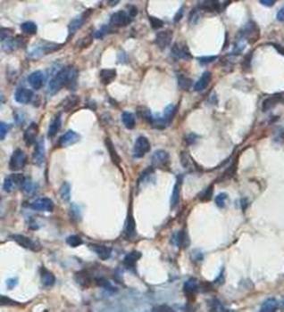 Immunohistochemical analysis of formalin-fixed paraffin embedded fetal spleen showing membrane staining using ADAP2 antibody 