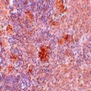 Immunohistochemical analysis of formalin-fixed and paraffin-embedded rat spleen tissue at 5 ug/mL using Slc37A2 antibody