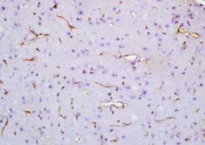 Immunohistochemical analysis of formalin-fixed paraffin embedded rat brain tissue using SV2A antibody (dilution at 1:200)