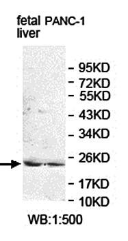 Western blot analysis of PANC-1 cell and fetal liver lysate using ISOC2 antibody 