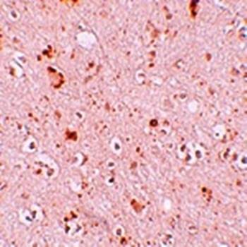  Immunohistochemical analysis of formalin-fixed and paraffin-embedded human brain tissue at 10 ug/mL using SH3RF2 antibody