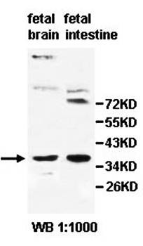 Western blot analysis of fetal barin and intestine lysate using PGLYRP3 antibody