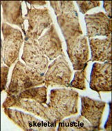  IHC-P of human skeletal muscle using SMPD4 antibody.