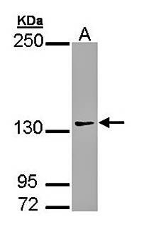 Western Blot analysis of A:A293T, whole cell lysate using AUTS2 antibody