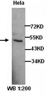 Western blot analysis of Hela cell lysates using MBD2 antibody