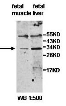 Western blot analysis of fetal muscle and liver lysate using ZNF138 antibody