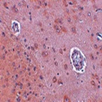  Immunohistochemical analysis of formalin-fixed and paraffin-embedded rat brain tissue at 2.5 ug/mL using FAM120A antibody
