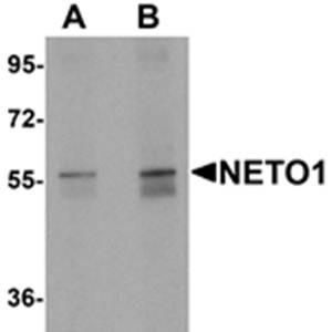 Western blot analysis of human lung tissue lysate at (A) 1 and (B) 2 ug/mL using NETO1 antibody