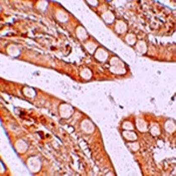  Immunohistochemical analysis of formalin-fixed and paraffin-embedded human small intestine tissue at 2.5 ug/mL using ZIP4 antibody