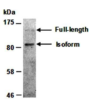 Western blot analysis of total cell extracts from human HepG2 using MBD5 antibody