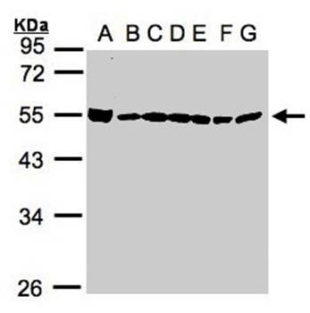 Western Blot analysis of A:293T, B:A431, C:H1299, D:Hela S3, E:HepG2 whole cell lysate using DDX39 antibody 