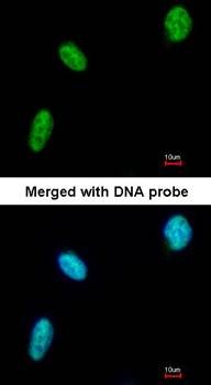  Confocal immunofluorescence analysis of paraformaldehyde-fixed HeLa using DDX39 antibody