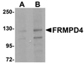 Western blot analysis of SK-N-SH cell lysate at (A) 1 and (B) 2 ug/mL using FRMPD4 antibody 