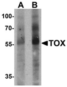 Western blot analysis of human colon tissue lysate at (A) 1 and (B) 2 ug/ml using TOX antibody