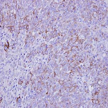  Immunohistochemical analysis of formalin-fixed and paraffin-embedded DLD-1 xenograft using SLC26A8 antibody