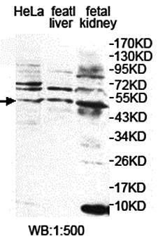 Western blot analysis of fetal kidney,fetal liverlysate and Hela cell lysate using PLCZ1 antibody 