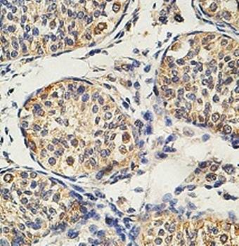  Immunohistochemical analysis of formalin-fixed paraffin embedded fetal testis showing cytoplasmic and nuclear staining using PLCZ1 antibody