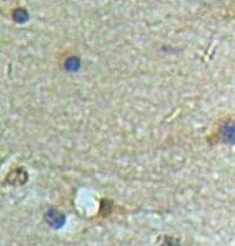 Immunohistochemical analysis of formalin-fixed paraffin embedded fetal brain showing membrane staining using PDE6B antibody 