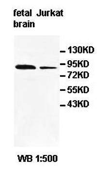  Western blot analysis of fetal brain and Jurkat cell lysate using PDE6B antibody