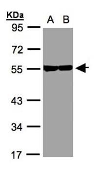 Western Blot analysis of A:A431, B:H1299 whole cell lysate using Tubulin beta 8 antibody 