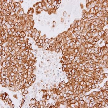  Immunohistochemical analysis of formalin-fixed and paraffin-embedded PC14 xenograft using Tubulin beta 8 antibody 