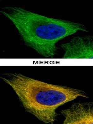  Confocal immunofluorescence analysis of paraformaldehyde-fixed U2OS using Tubulin beta 8 antibody