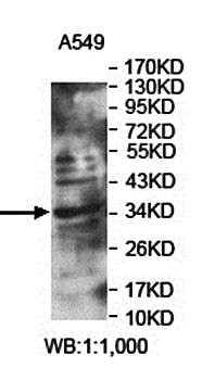 Western blot analysis of A549 cell lysate using LRRC46 antibody 